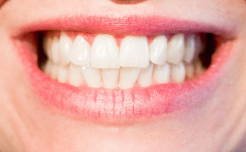 Nowoczesna technika stosowana w salonach stomatologii estetycznej może sprawić, że odzyskamy ładny uśmiech.